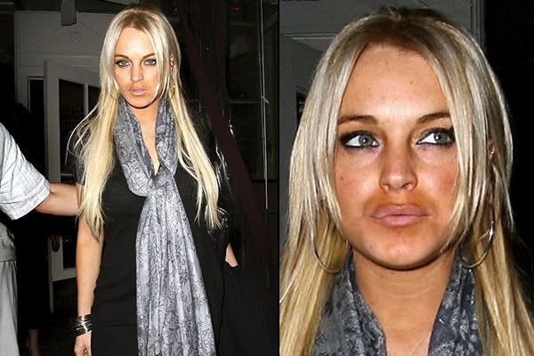 lindsay-lohan-surgery.jpg