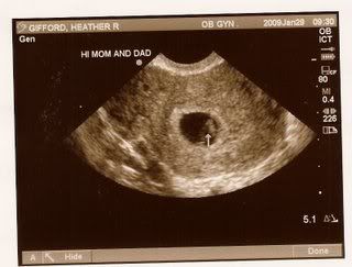 7 week ultrasound yesterday! - BabyCenter